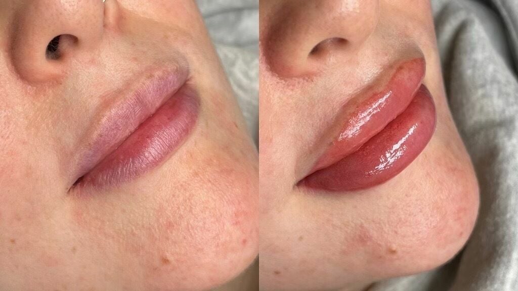 Close-up model's lips performed with permanent lip makeup. Lip tattoo work  after tattoo - Stock Image - Everypixel